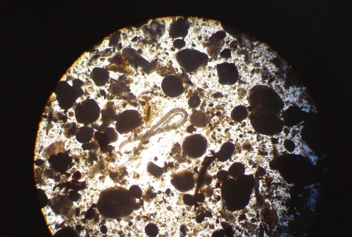 生吃泥鰍可感染棘顎口線蟲需手術(shù)根除